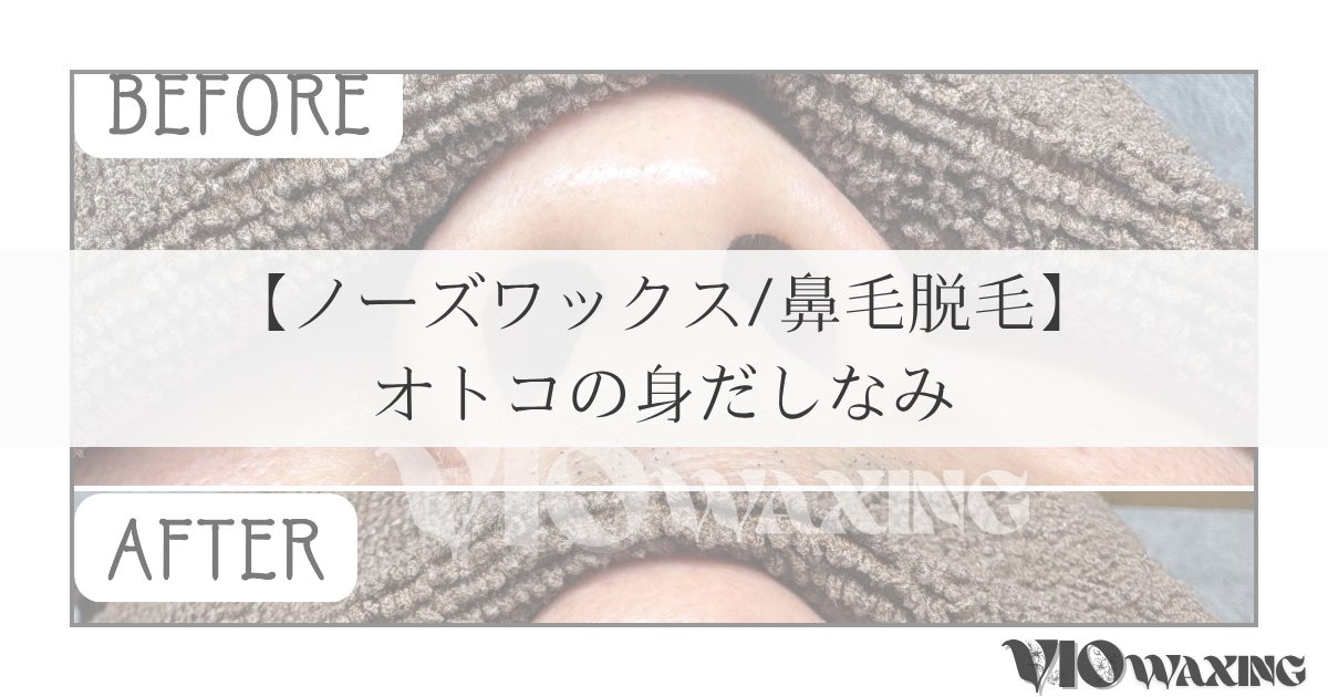 松山メンズ脱毛