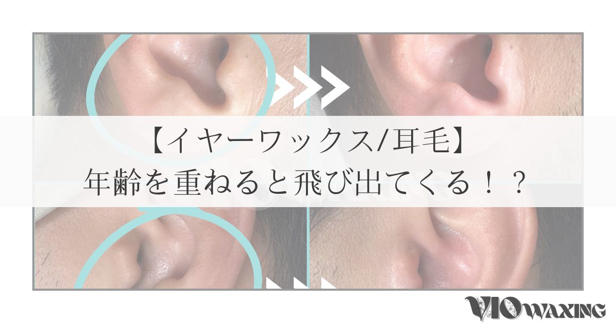 耳毛ワックス 耳毛脱毛 耳毛処理 松山市