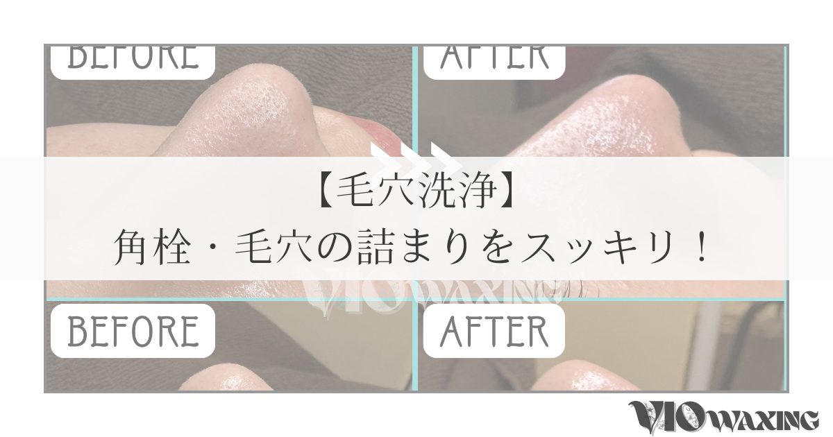 毛穴洗浄 愛媛県松山市 VIO WAXING