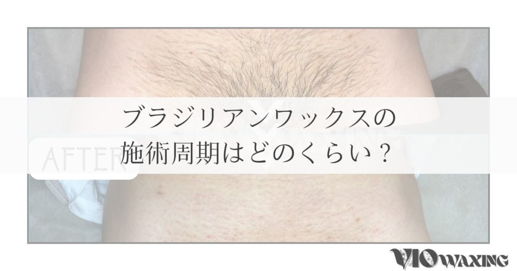 ブラジリアンワックス ワックス脱毛 周期