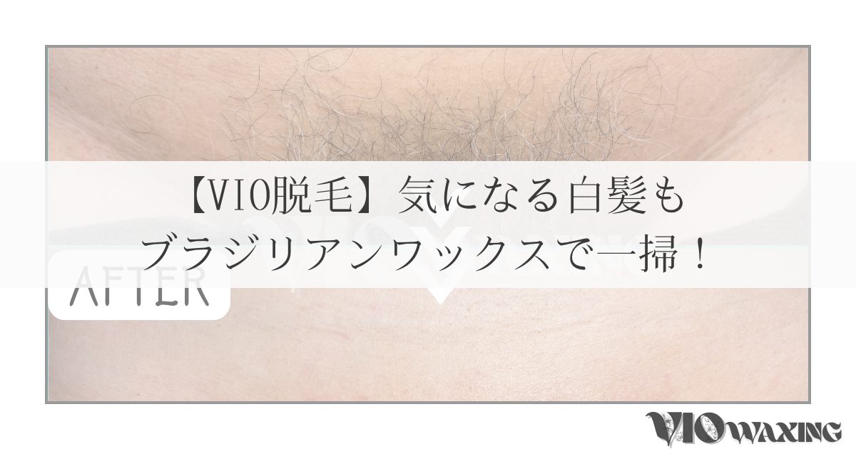 ワックス脱毛 白髪脱毛 VIO メンズ脱毛