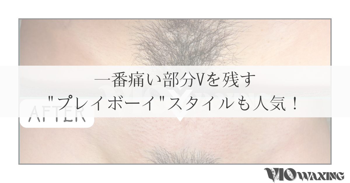 VIOワックス脱毛 ブラジリアンワックス 松山 愛媛