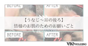 うなじ ワックス 愛媛 松山 VIO WAX 襟足
