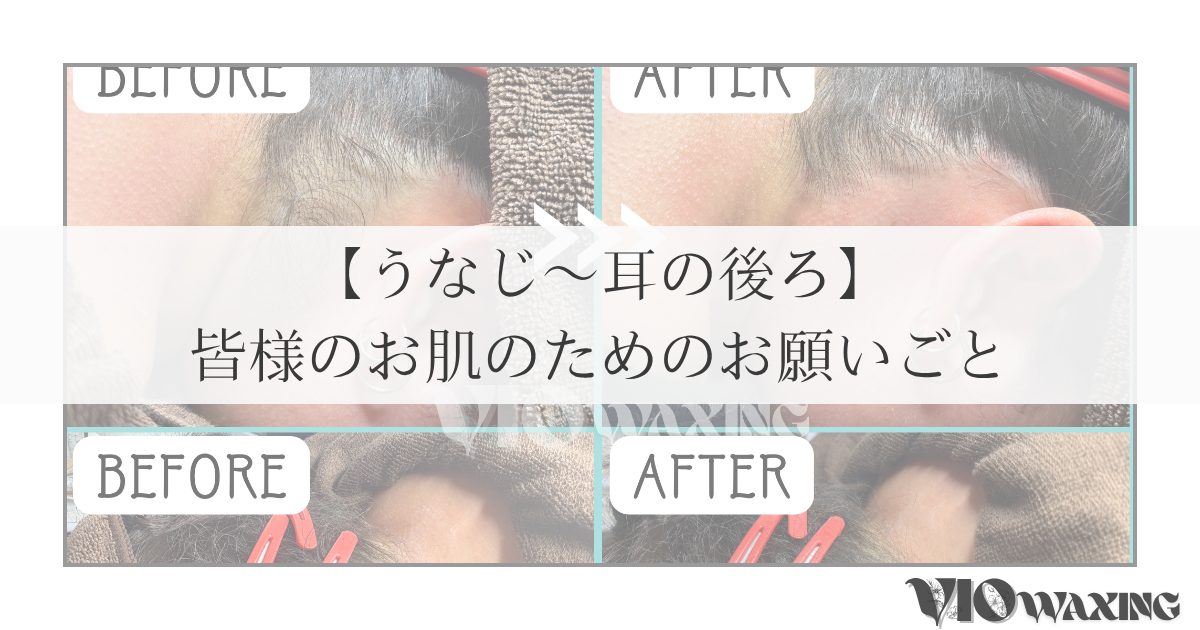 うなじ ワックス 愛媛 松山 VIO WAX 襟足