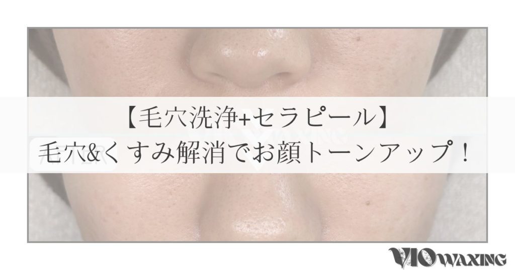 セラピール ララピール ラミピール 韓国 肌管理 ピーリング フェイシャル