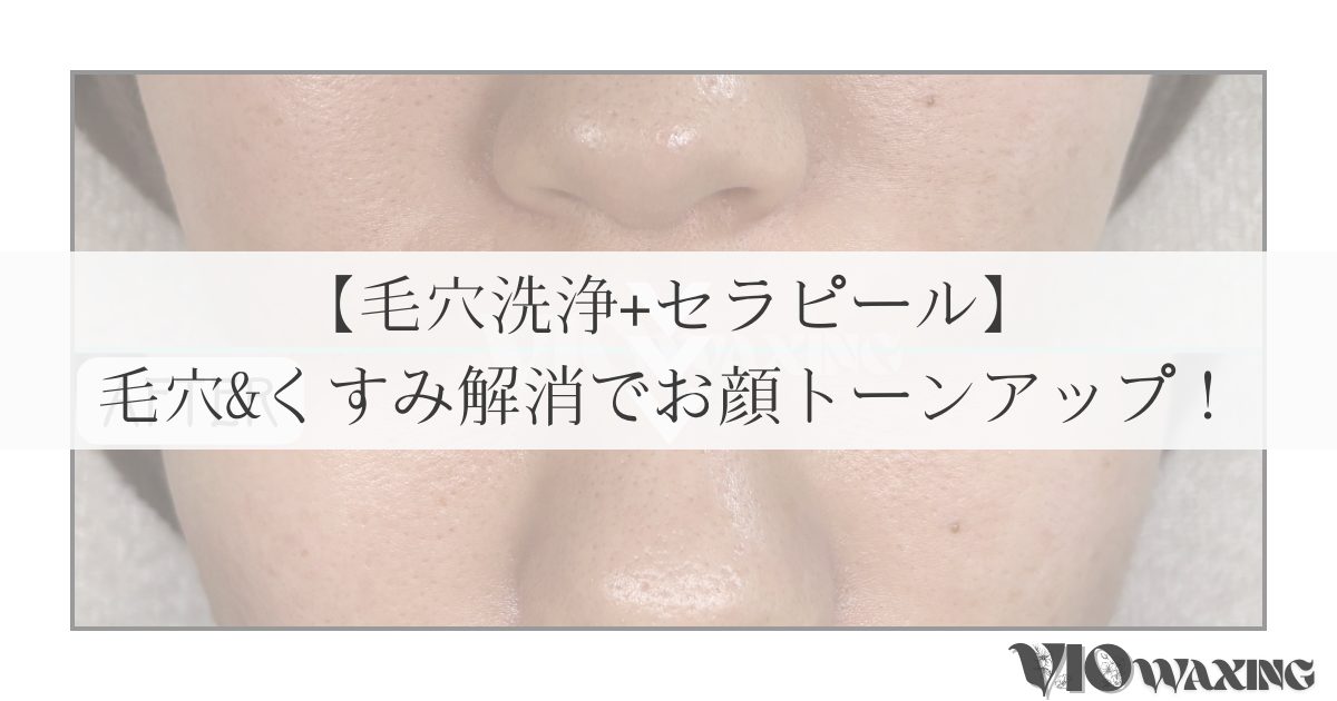 セラピール ララピール ラミピール 韓国 肌管理 ピーリング フェイシャル