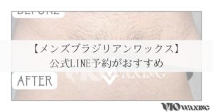 メンズブラジリアンワックス メンズ脱毛 vio 松山市
