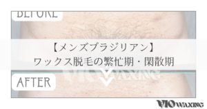 メンズブラジリアンワックス vio ワックス脱毛 男性 松山市 愛媛