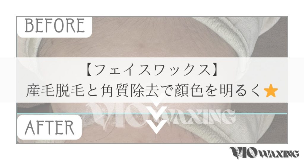 フェイスワックス 松山市 顔脱毛 産毛脱毛