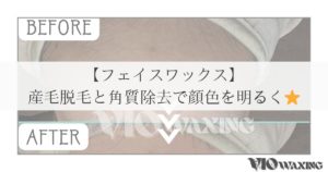フェイスワックス 松山市 顔脱毛 産毛脱毛