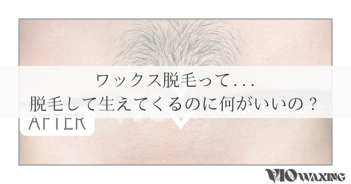 ブラジリアンワックス vio ワックス脱毛 松山市 愛媛 すぐ脱毛 痛い