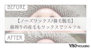 ノーズワックス 鼻毛 脱毛 メンズ脱毛 男 身だしなみ 松山市