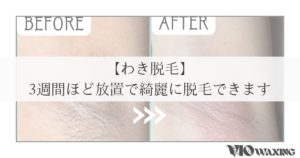 両脇 わき 脱毛 ワックス脱毛 ブラジリアンワックス
