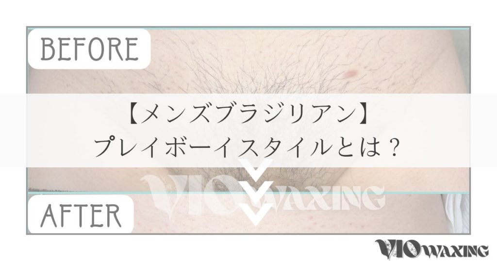 メンズ ブラジリアンワックス vio脱毛 ワックス脱毛 松山市 愛媛 メンズ脱毛 V残し