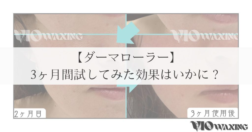 ダーマローラー Dermaroller GmbH HC902