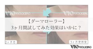 ダーマローラー Dermaroller GmbH HC902