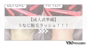 うなじ ワックス 耳の後ろ 脱毛 松山市 成人式 準備