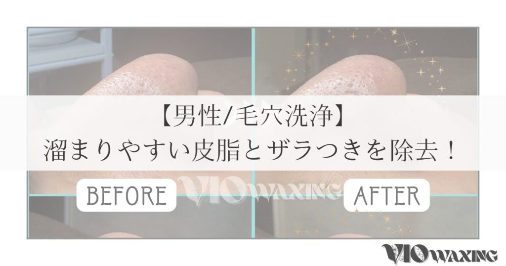 毛穴洗浄 エステサロン 松山市 愛媛 メンズ 男性