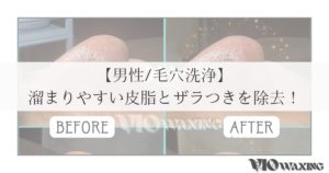 毛穴洗浄 エステサロン 松山市 愛媛 メンズ 男性