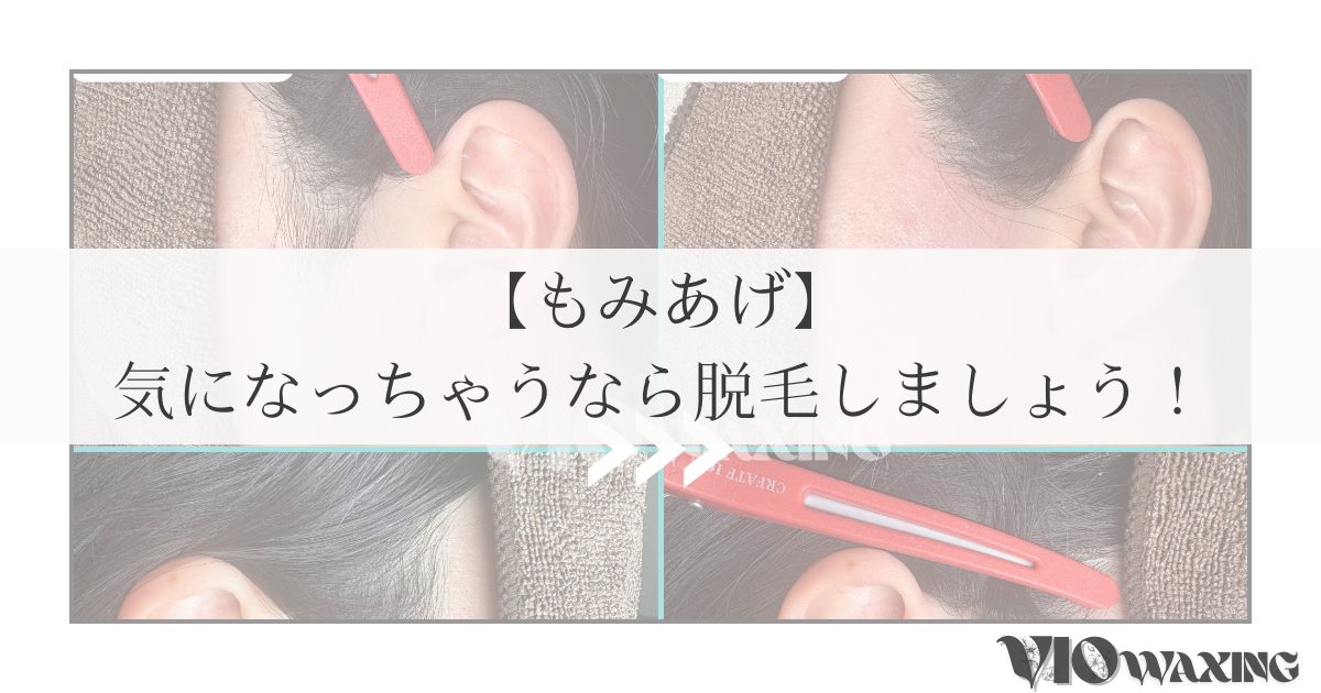 もみあげ ワックス 脱毛 松山市 愛媛