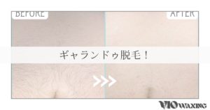 お腹周り ギャランドゥ 脱毛 松山市 愛媛